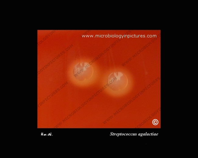 s.agalactiae colonies with beta-hemolysis